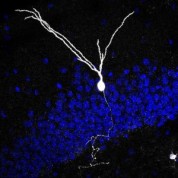 Axons Found To Be Important In Recovering From TBI